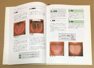 舌診と脈診 中醫(yī)臨床における実踐的アプローチの再検討